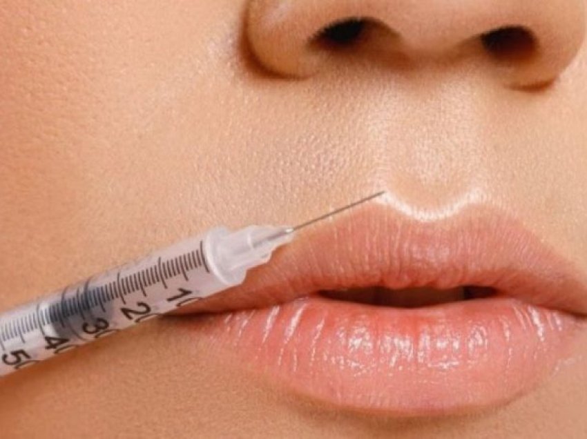Efektet anësore që shkaktohen nga mbushja e buzëve