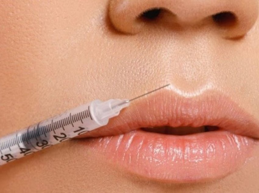 Efektet anësore që shkaktohen nga mbushja e buzëve