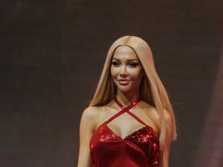 Fitoi Miss Moska, shpërthejnë kritikat ndaj modeles: Duhet të fitonte kirurgu i saj plastik