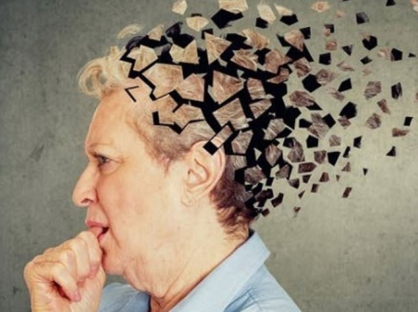 Dhjetë simptomat fillestare të Alzheimerit që duhet t’i njihni