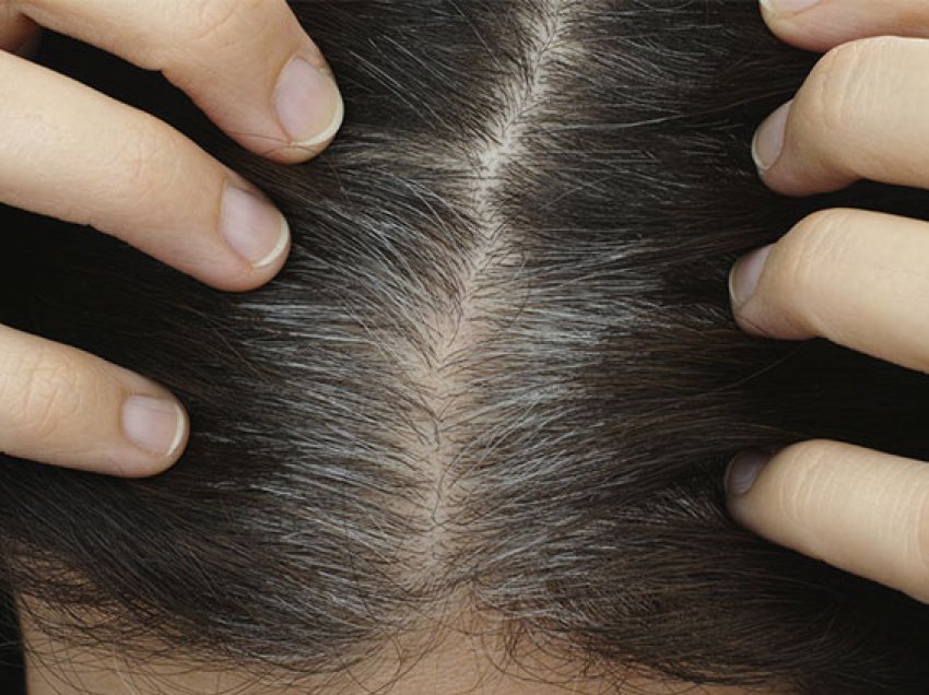 Shkencëtarët zbulojnë arsyen e thinjave në flokë