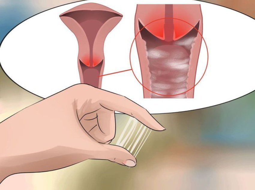 Mjekimi i parë nis nga ju, 4 gjërat që duhet të bëni në rast se vini re sekrecione vaginale jonormale