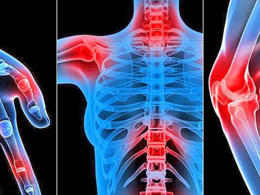 Ndikimi i plakjes në kocka, ja si rigjenerohet skeleti ynë çdo 10 vjet