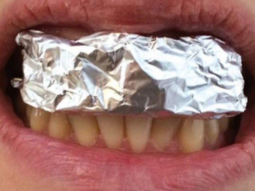 Nuk ka asnjë efekt anësor, metoda me letër alumini për zbardhjen e thjeshtë të dhëmbëve