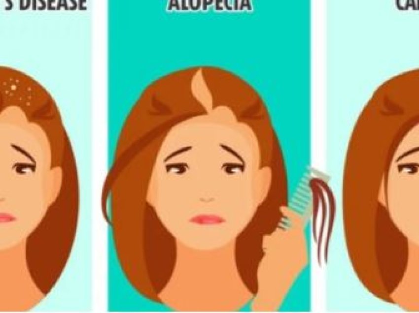 Këto ndryshime në flokë mund të jenë shenja se keni probleme serioze shëndetësore