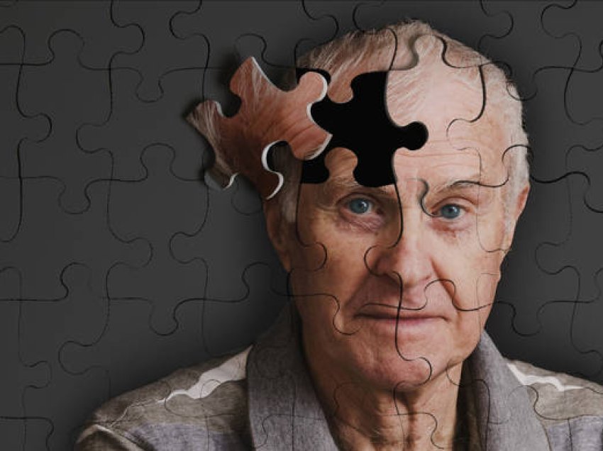 5 simptoma që i paraprijnë Alzheimerit