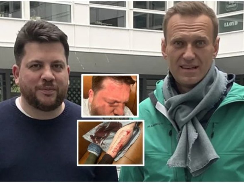 Sulmohet me çekan ndihmësi i Navalnyt