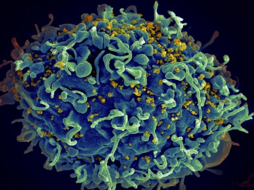​Shkencëtarët eliminojnë me sukses HIV nga qelizat